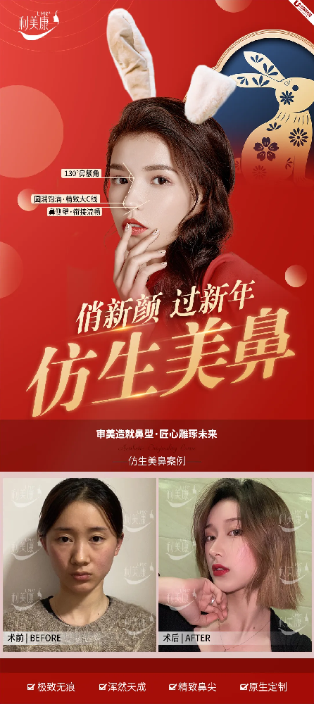 利美康新年整容对比图